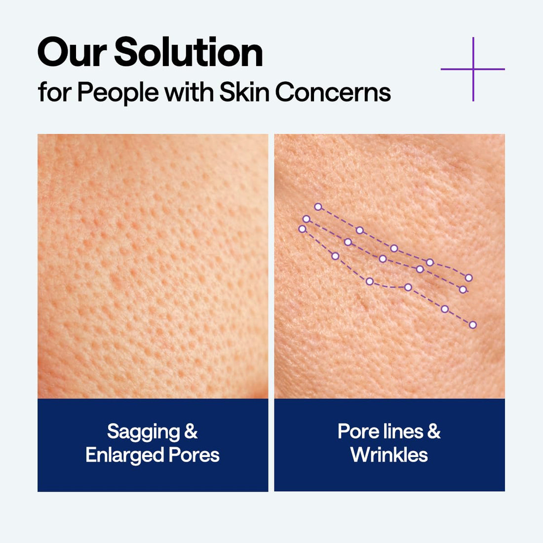 [MEDIHEAL] PDRN Lifting Serum