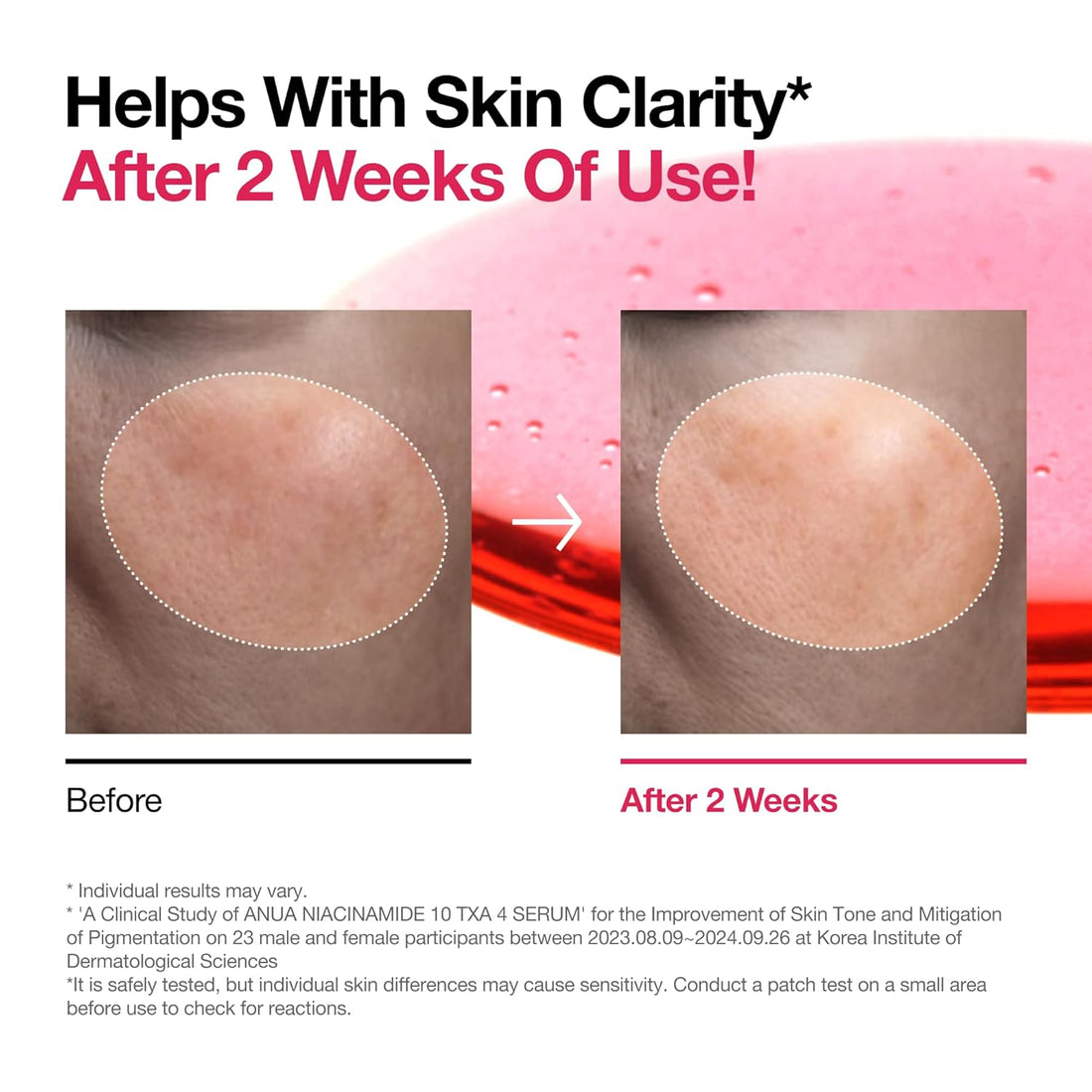 [ANUA] NIACINAMIDE 10%+TXA 4% Serum 30ml (RENEW)