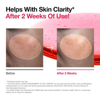 [ANUA] NIACINAMIDE 10%+TXA 4% Serum 30ml (RENEW)