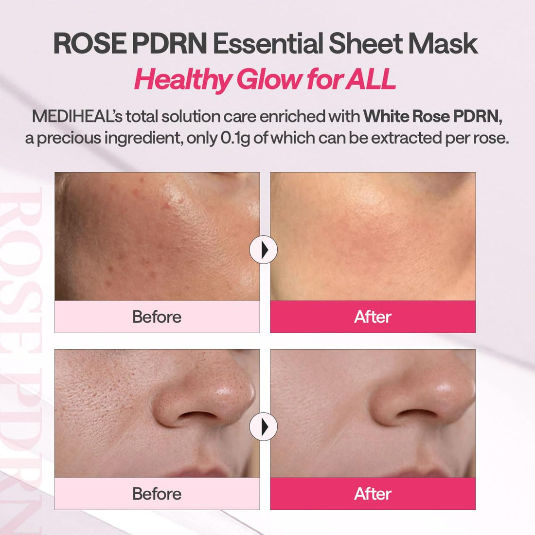[MEDIHEAL] Rose PDRN Essential Mask - Healthy Glow 10pcs