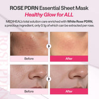 [MEDIHEAL] Rose PDRN Essential Mask - Healthy Glow 10pcs
